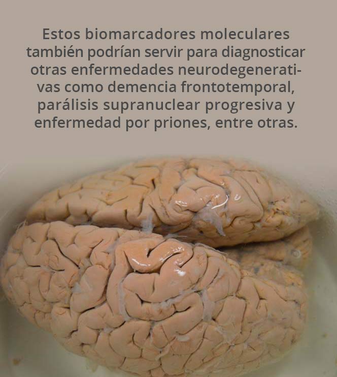 800 Cerebro 01