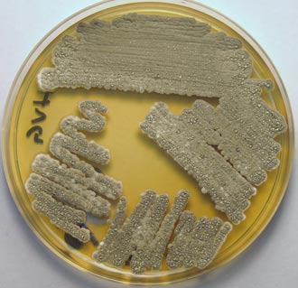 Bacteria-Streptomyces-sp-A4.-Fotografía-del-Dr.-Zahaed-Evangel.jpg