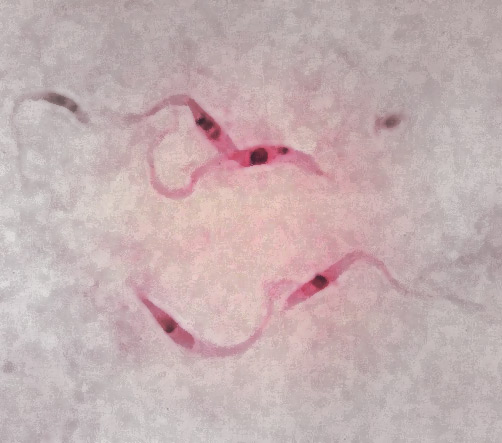 Trypanosoma_cruzi_1806.jpg