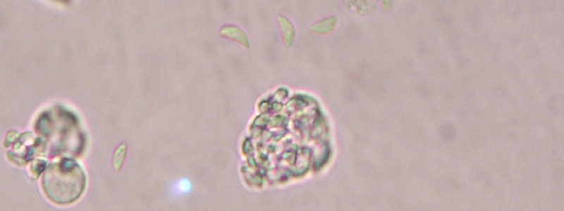 HEAD toxoplasmosis2416