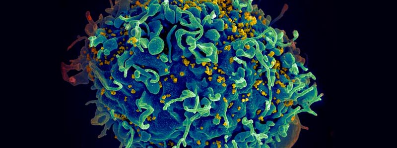 celula infectada VIH NIH USA