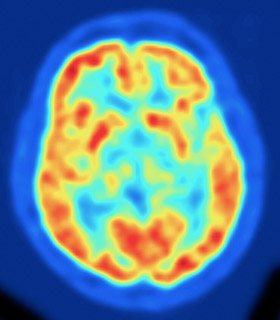 tomografia cerebro humano01