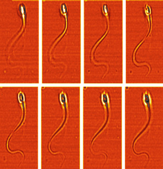 movimiento espermatozoide corkidi
