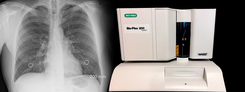 800x300-Pulmones-1709.jpg