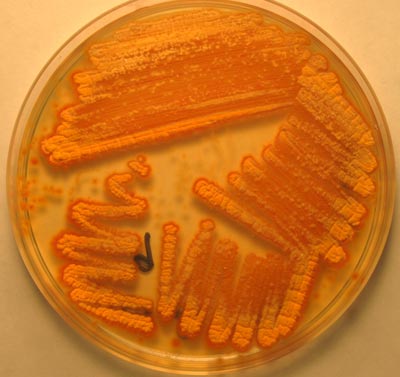 Streptomyces sp A5. Fotografia del Dr. Zahaed Evangelista Martinez