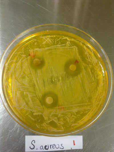 Efecto-antimicrobiano-de-extractos-de-jamaica-en-medio-de-cultivo-1.jpg