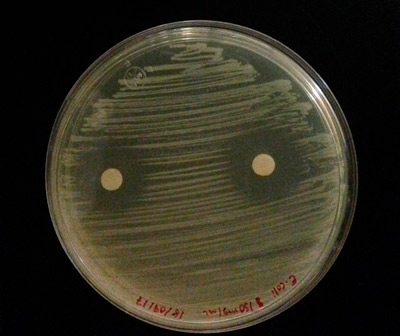 Evaluación-de-la-actividad-antimicrobiana-en-Escherichia-coli2.jpg