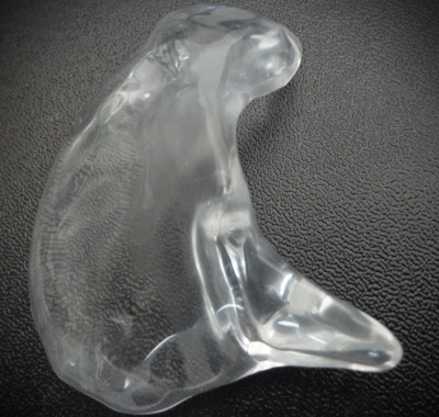 implante craneo 3d