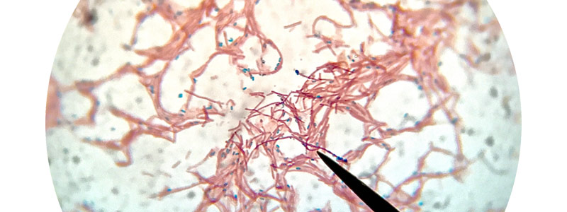 banner bacillus subtilis